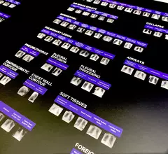 AI applications developed by Annalise.ai and commercialized outside the U.S. The company is working on gaining FDA for these and had several FDA clearances granted this past year. Photo by Dave Fornell. #RSNA #RSNA23 #RSNA2023