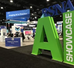The integration of artificial intelligence (AI) into radiology PACS and enterprise imaging systems has become a big topic of discussion with IT vendors over the past couple years. This has become a bigger question from hospitals and radiology groups as there are now about 400 radiology related AI algorithms that have U.S. Food and Drug Administration (FDA) clearance. Amy Thompson, a senior analyst at Signify Research, is monitoring radiology AI trends. Photo by Dave Fornell