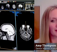 Amy Thompson, a senior analyst at Signify Research, explains what she is seeing in the market for radiology PACS. She said the biggest overall strategic technology trends are wider adoption of enterprise imaging systems expanding beyond radiology to include other departments, migration to cloud data storage, and adoption of artificial intelligence. Components of these integrate into the 5 trends in radiology IT systems outlined below.