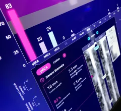 An example of an FDA cleared radiology AI algorithm to automatically take a cardiac CT scan and identify, contour and quantify soft plaque in the coronary arteries. The Cleerly software then generates an automated report with images, measurements and a risk assessment for the patient. This type of quantification is too time consuming and complex for human readers to bother with, but AI assisted reports like this may become a new normal over the next decade. Example from Cleerly Imaging at SCCT 2022.