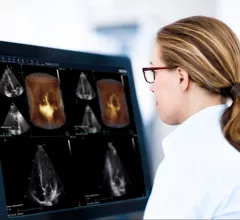 Cardiovascular information systems (CVIS) combine imaging and reporting into one system that allows access across the cardiovascular service line. Here are 7 trends in CVIS according to KLAS.