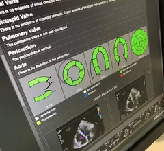 An echo reporting page from the Philips CVIS at ACC 2022. Best in KLAS 2023 rankings for cardiovascular information systems.