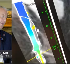Ed Nicol, MD, consultant cardiologist and honorary senior clinical lecturer with Kings College London and president-elect of the Society of Cardiovascular Computed Tomography (SCCT), explained artificial intelligence (AI) in cardiac CT is here to stay and its use is expanding. He noted that one AI-based algorithm is already included in recent cardiology guidelines and more will likely follow. #SCCT