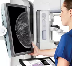 probably benign abnormalities on mammogram