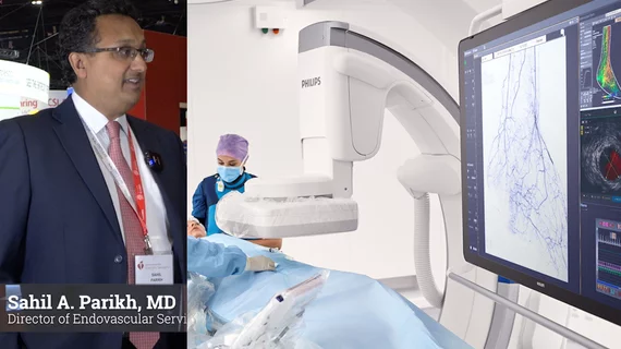 Sahil A. Parikh, MD, Director of Endovascular Services at Columbia University Irving Medical Center and Associate Professor of Medicine at the Columbia University College of Physicians and Surgeons, explained the growing trend or interventional cardiologists treating PAD and CLI. He shares what he thinks is important for cardiology departments to know before expanding expanding their programs in this space.