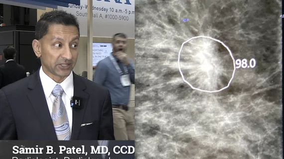 Video of Samir Patel, MD, diagnostic radiologist at Radiology Inc., value management program founder and director and a board member of the Beacon Health System, explaining how AI is being implemented in mammography at RSNA 2023.